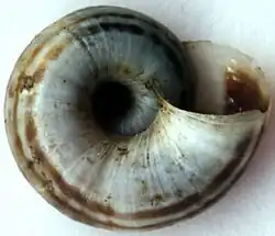 Umbilical view