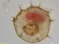 Centropyxis aculeata