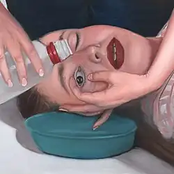 A painting of depicting Florence Shaw's right eye being rinsed with liquid from a bottle and draining into a bowl, administered by someone with their face out of frame.